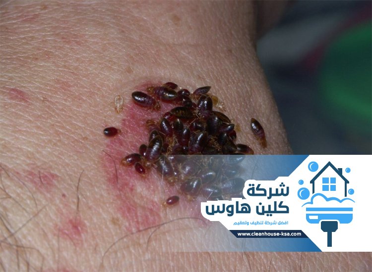 شركة مكافحة بق الفراش بالمدينة